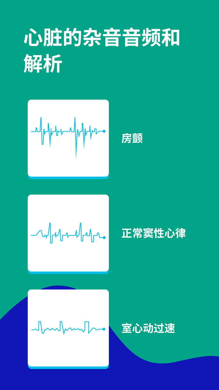 心电图ECG3